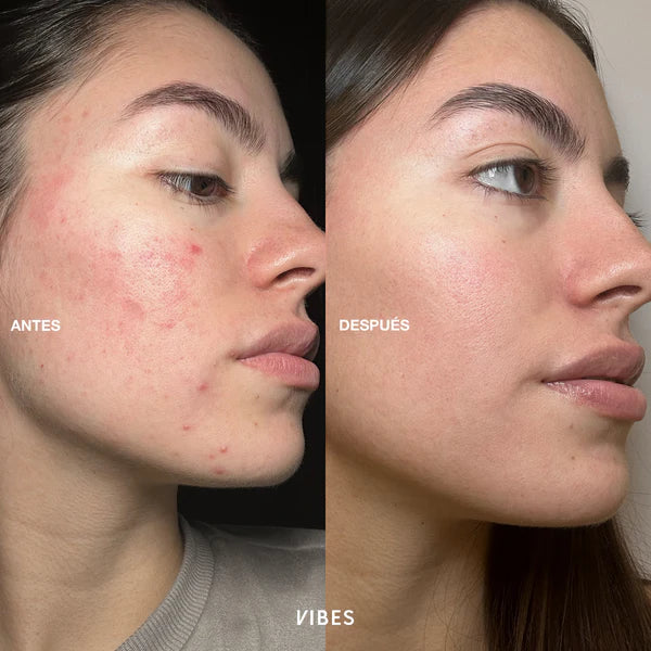 LIMPIADOR FACIAL 90ML VIBES